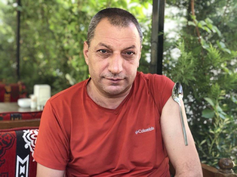 Korona aşısı oldu kolu mıknatıs gibi metal eşyaları çekmeye başladı