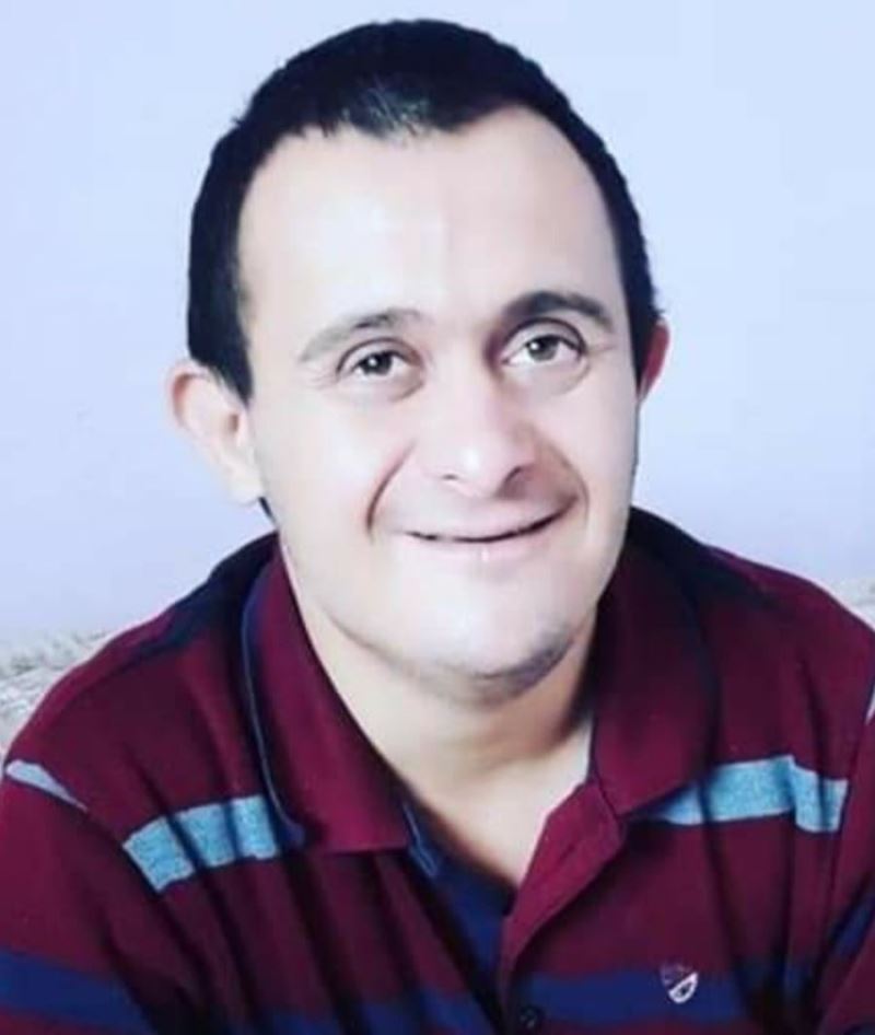 Kızıltepe ’de down sendromlu genç korona virüse yenik düştü