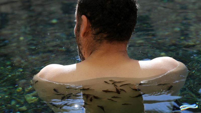 Sedef hastaları şifayı 