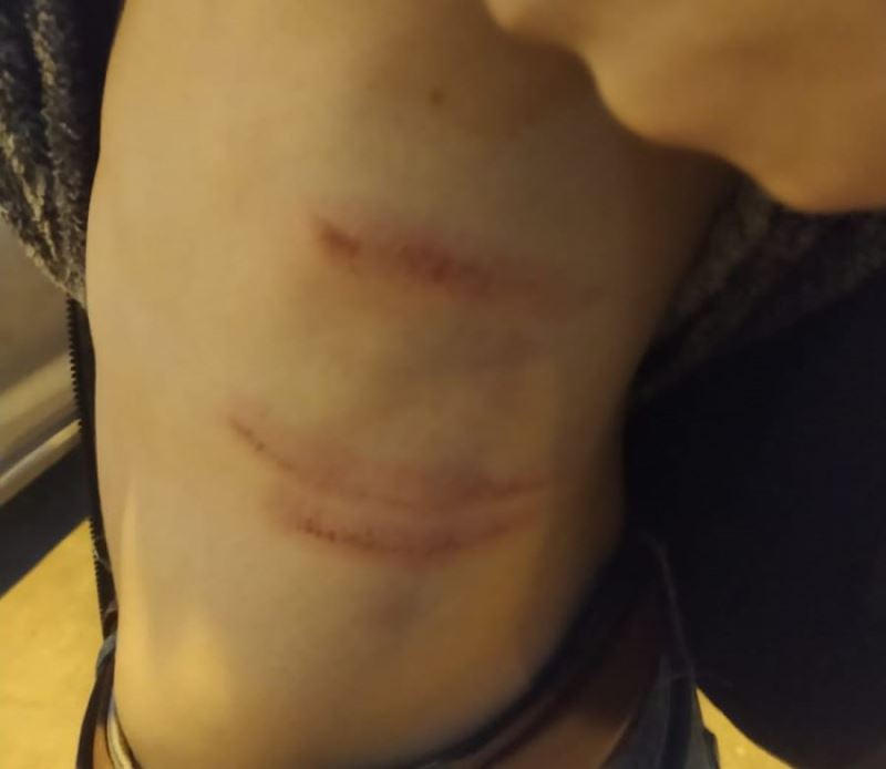 Mardin’de amatörde olaylı maç