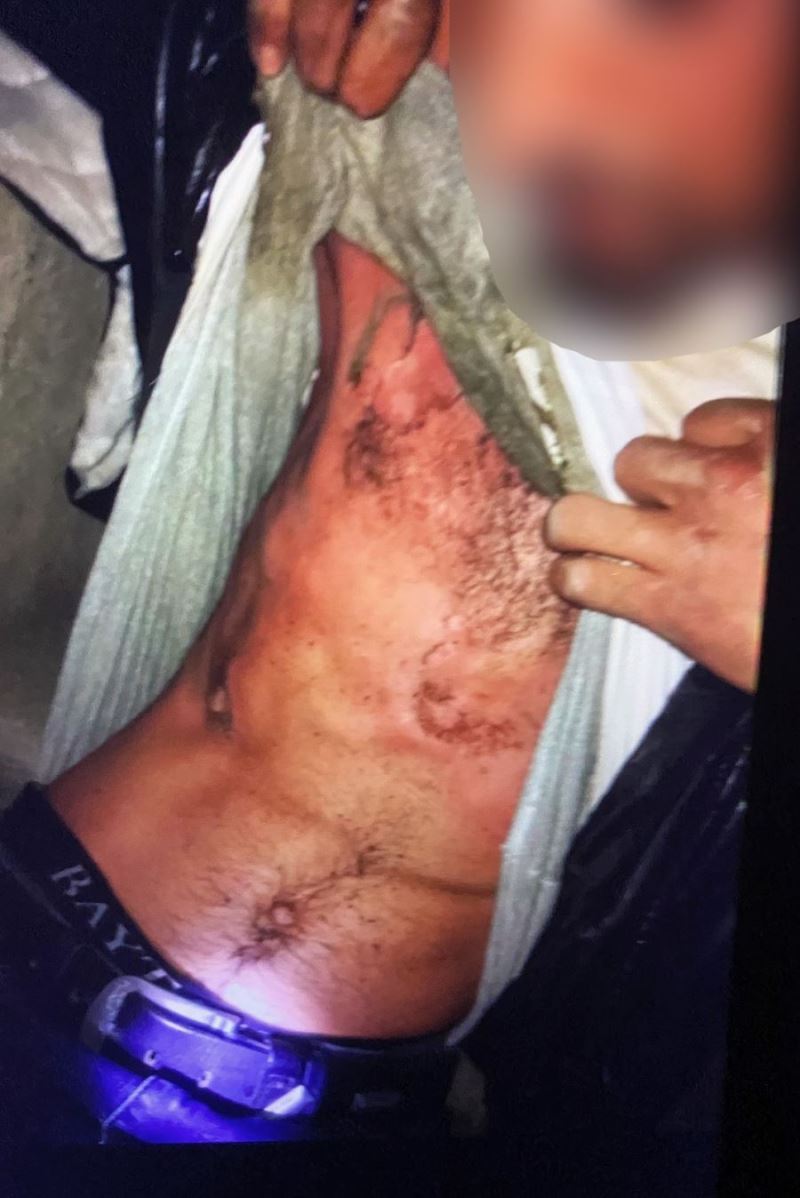 Hırsızlık amacıyla girdiği elektrik trafosunda akıma kapıldı