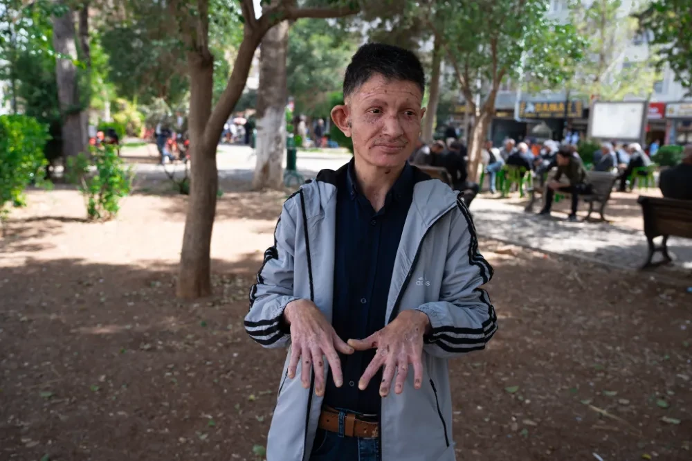 Kızıltepeli Murat 29 yıldır bu acıyı çekiyor